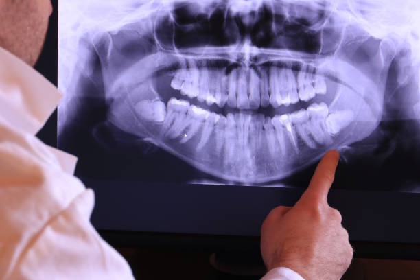 Best Emergency Treatment for Dental Infections or Abscesses in Eatons Neck, NY